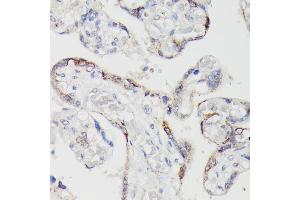 Immunohistochemistry of paraffin-embedded human placenta using SPON2 antibody (ABIN6129679, ABIN6148370, ABIN6148372 and ABIN6215647) at dilution of 1:100 (40x lens).