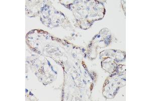 Immunohistochemistry of paraffin-embedded human placenta using SPON2 antibody (ABIN6129679, ABIN6148370, ABIN6148372 and ABIN6215647) at dilution of 1:100 (40x lens). (SPON2 anticorps  (AA 27-150))