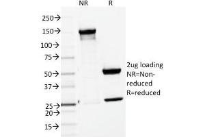 SDS-PAGE Analysis Purified ENAH / MENA Mouse Monoclonal Antibody (ENAH/1988).