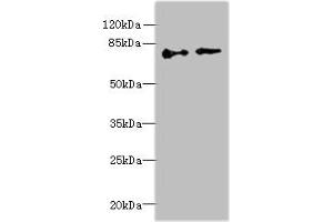 Western blot All lanes: ECD antibody at 6 μg/mL Lane 1: Hela whole cell lysate Lane 2: U251 whole cell lysate Secondary Goat polyclonal to rabbit IgG at 1/10000 dilution Predicted band size: 73, 68, 77 kDa Observed band size: 73 kDa (ECD/SGT1 anticorps  (AA 1-300))