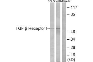 Western blot analysis of extracts from COLO cells and HepG2 cells, using TGF beta Receptor I (epitope around residue 165) antibody.