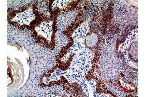 Immunohistochemistry (IHC) analysis of paraffin-embedded Human Skin, antibody was diluted at 1:100. (CLEC11A anticorps)