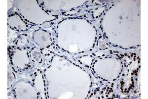 Image no. 3 for anti-Nibrin (NBN) (AA 183-460) antibody (ABIN1491059)