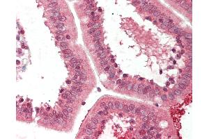 anti-Collagen Triple Helix Repeat Containing 1 (CTHRC1) (C-Term) antibody