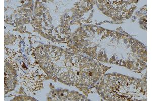 ABIN6269244 at 1/100 staining Mouse testis tissue by IHC-P.