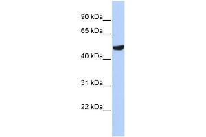 WB Suggested Anti-SEPT11(septin 11) Antibody Titration: 0. (Septin 11 anticorps  (N-Term))