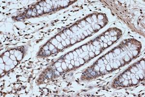 Immunohistochemistry of paraffin-embedded human colon using SRSF3 Rabbit mAb (ABIN7270216) at dilution of 1:100 (40x lens). (SRSF3 anticorps)
