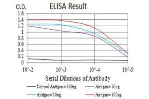 Black line: Control Antigen (100 ng),Purple line: Antigen (10 ng), Blue line: Antigen (50 ng), Red line:Antigen (100 ng)