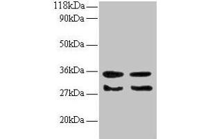 Western blot All lanes: TGFA antibody at 2 μg/mL Lane 1: EC109 whole cell lysate Lane 2: 293T whole cell lysate Secondary Goat polyclonal to rabbit IgG at 1/15000 dilution Predicted band size: 18, 17 kDa Observed band size: 30, 35 kDa