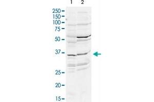 Western Blot analysis of mouse WT brain (A) and rat brain (B) tissue lysates with DLX2 polyclonal antibody  at 2 ug/mL working concentration. (DLX2 anticorps  (N-Term))