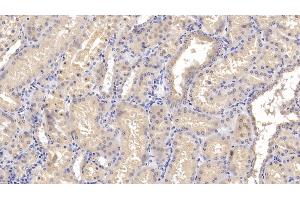 Detection of OPG in Human Kidney Tissue using Polyclonal Antibody to Osteoprotegerin (OPG)