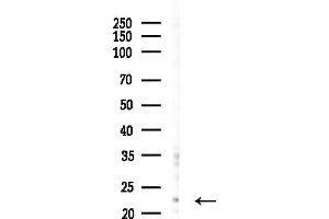 anti-Second Mitochondria-Derived Activator of Caspase (DIABLO) (C-Term) antibody