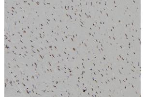 ABIN6273594 at 1/100 staining Rat heart tissue by IHC-P. (BCL11B anticorps  (Internal Region))