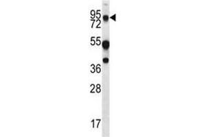 MUC20 antibody western blot analysis in WiDr lysate.