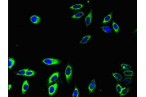 Immunofluorescent analysis of Hela cells using ABIN7158537 at dilution of 1:100 and Alexa Fluor 488-congugated AffiniPure Goat Anti-Rabbit IgG(H+L)