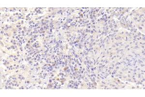 Detection of BAFFR in Human Spleen Tissue using Polyclonal Antibody to B-Cell Activation Factor Receptor (BAFFR)
