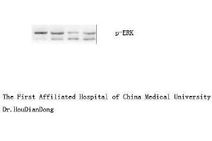 Western Blot (WB) analysis: Please contact us for more details. (ERK1/2 anticorps  (pTyr204))