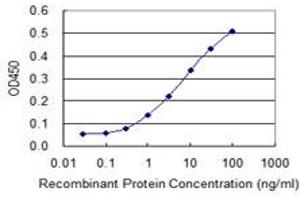 Detection limit for recombinant GST tagged LMTK3 is 0. (LMTK3 anticorps  (AA 1151-1250))