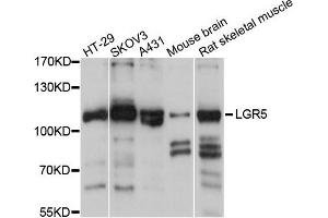 Western blot analysis of extracts of various cells, using LGR5 antibody. (LGR5 anticorps)