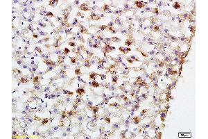 Formalin-fixed and paraffin embedded rat liver labeled with Anti-PCK2 Polyclonal Antibody, Unconjugated (ABIN708206) at 1:200 followed by conjugation to the secondary antibody and DAB staining (PEPCK anticorps  (AA 365-470))