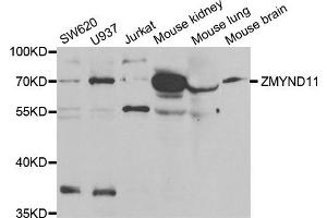 Western Blotting (WB) image for anti-Zinc Finger, MYND-Type Containing 11 (ZMYND11) antibody (ABIN1980343)