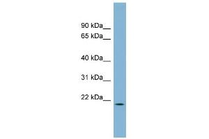 WB Suggested Anti-C4orf28 Antibody Titration: 0. (PACRGL anticorps  (Middle Region))