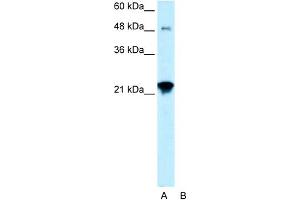 WB Suggested Anti-LASS2 Antibody Titration:  0. (Ceramide Synthase 2 anticorps  (N-Term))