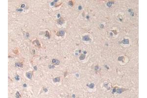 Detection of CD299 in Human Cerebrum Tissue using Polyclonal Antibody to Cluster Of differentiation 299 (CD299)