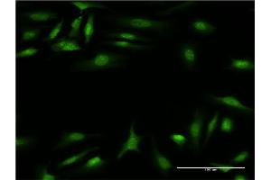 Immunofluorescence of monoclonal antibody to CALCOCO2 on HeLa cell.