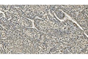 IHC analysis of Carbonic Anhydrase I/CA1 using anti-Carbonic Anhydrase I/CA1 antibody (ABIN7602621). (CA1 anticorps  (AA 9-261))