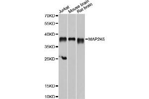 Western blot analysis of extracts of various cell lines, using MAP2K6 antibody. (MAP2K6 anticorps)