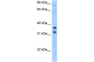 WB Suggested Anti-KCNRG Antibody Titration:  2. (KCNRG anticorps  (N-Term))