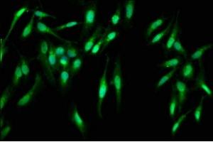 Immunofluorescence staining of Hela cells with ABIN7146938 at 1:400, counter-stained with DAPI. (Caspase 2 anticorps  (AA 2-452))