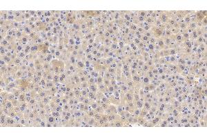 Detection of GPX1 in Mouse Liver Tissue using Polyclonal Antibody to Glutathione Peroxidase 1 (GPX1)