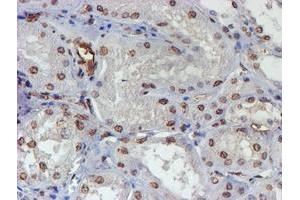 Immunohistochemical staining of paraffin-embedded Human Kidney tissue using anti-ELK3 mouse monoclonal antibody. (ELK3 anticorps)