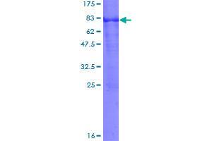 Image no. 1 for Arylsulfatase A (ARSA) (AA 1-507) protein (GST tag) (ABIN1345739)