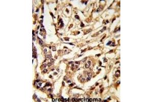 anti-Galactose-1-Phosphate Uridylyltransferase (GALT) antibody