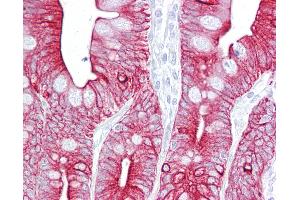 Anti-KRT8 / Cytokeratin 8 antibody IHC of human small intestine.