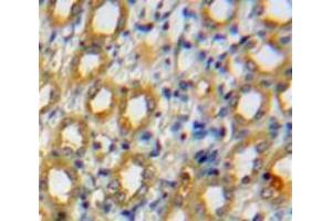Used in DAB staining on fromalin fixed paraffin-embedded Kidney tissue