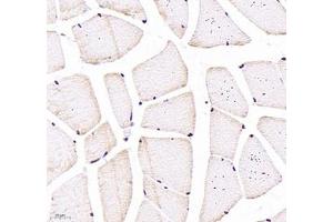 Immunohistochemistry of paraffin embedded rat skeletal muscle using CNG1 (ABIN7073608) at dilution of 1:700 (400x lens) (CNGA1 anticorps)