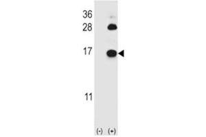 Western blot analysis of FABP4 antibody and 293 cell lysate (2 ug/lane) either nontransfected (Lane 1) or transiently transfected (2) with the FABP4 gene. (FABP4 anticorps  (AA 1-30))