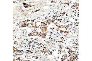 IHC analysis of USP5 using anti-USP5 antibody (ABIN7599551). (USP5 anticorps  (AA 1-800))