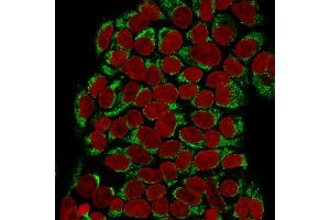 Immunofluorescence Analysis of Human MCF-7 cells labeling GnRH-R with GnRH-Receptor Mouse Monoclonal Antibody (F1G4) followed by Goat anti-mouse IgG-CF488 (Green). (GNRHR and LHCGR (AA 1-29), (N-Term) anticorps)