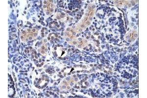 Image no. 1 for anti-TAF1 RNA Polymerase II, TATA Box Binding Protein (TBP)-Associated Factor, 250kDa (TAF1) (C-Term) antibody (ABIN6735891)