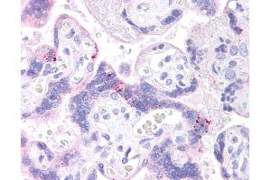 Immunohistochemistry (IHC) image for anti-ATP-Binding Cassette, Sub-Family B (MDR/TAP), Member 1 (ABCB1) (Middle Region) antibody (ABIN2773986)