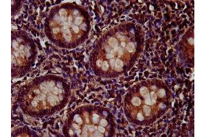 IHC image of ABIN7166237 diluted at 1:200 and staining in paraffin-embedded human appendix tissue performed on a Leica BondTM system.