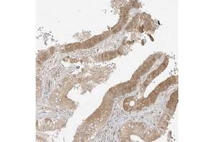 Immunohistochemical staining of human gallbladder with LIPT1 polyclonal antibody  shows moderate cytoplasmic positivity in glandular cells. (LIPT1 anticorps)