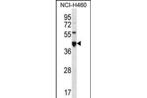 CEAC Antibody (N-term) (ABIN656216 and ABIN2845533) western blot analysis in NCI- cell line lysates (35 μg/lane). (CEACAM18 anticorps  (N-Term))