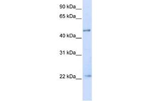 WB Suggested Anti-TRIM21 Antibody Titration:  0. (TRIM21 anticorps  (N-Term))