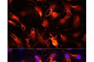 anti-Ring Finger Protein 149 (RNF149) antibody